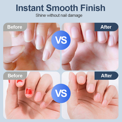 💅 KAUF 2 ERHALT 1! ✨ UNIVERSALER NAGELSCHLEIFER - 6 Schärfstufen & Auto-Stopp, Sicher und Leise für Professionelle Maniküre zu Hause