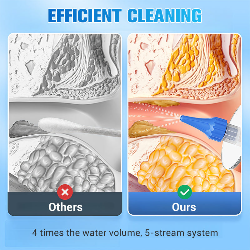 🌞Frühlingserwachen: 50% Rabatt!🧼 Ohrenschmalz-Entfernungsset (E20/W10) – Sicher & sanft, mit austauschbaren Aufsätzen für schmerzlose Ohrenreinigung!