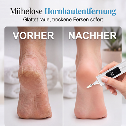 💅 1 kaufen, 1 gratis! Elektrischer Nagelfräser für Nagelpilz & Maniküre – zum Schleifen, Polieren & Entfernen von Gelnägeln✨